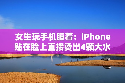 女生玩手机睡着：iPhone贴在脸上直接烫出4颗大水泡！