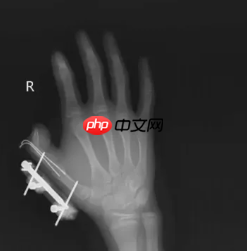 网购收到这东西 千万当心！会爆炸、会“放毒”