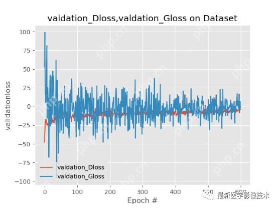 USenhance2023——2023 年超声图像增强挑战赛