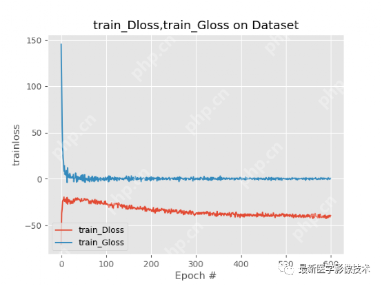 USenhance2023——2023 年超声图像增强挑战赛