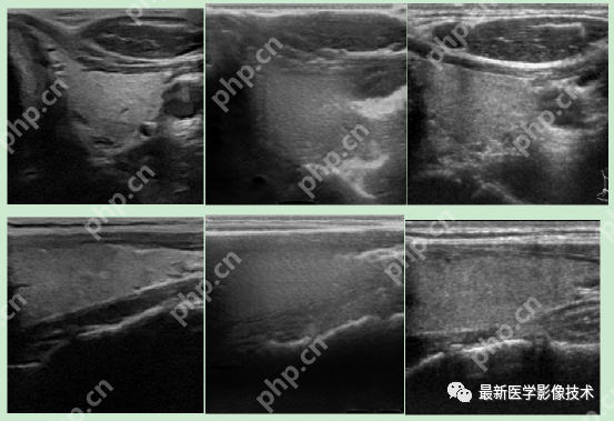 USenhance2023——2023 年超声图像增强挑战赛