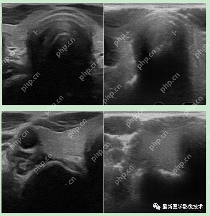 USenhance2023——2023 年超声图像增强挑战赛